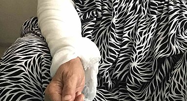 74 yaşındaki kadın, taş ve sopalı saldırıda darp edilme anlarını anlattı