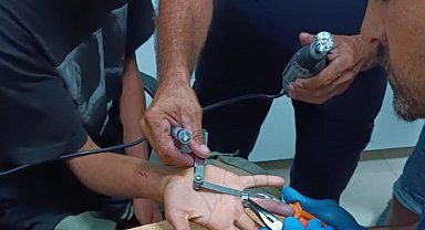 Parmağa sıkışan yüzük kesilerek çıkarıldı