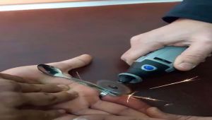 Gencin Parmağında Sıkışan Yüzüğü, İtfaiye Ekipleri Çıkardı - Videolu Haber