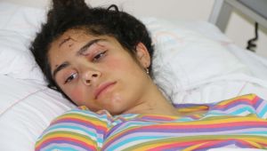 Gölbaşı'nda 6 Köpeğin Saldırdığı Genç Kız Ağır Yaralandı - Videolu Haber