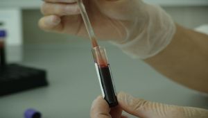 Kolon kanserinde karaciğer metastazı riskine dikkat